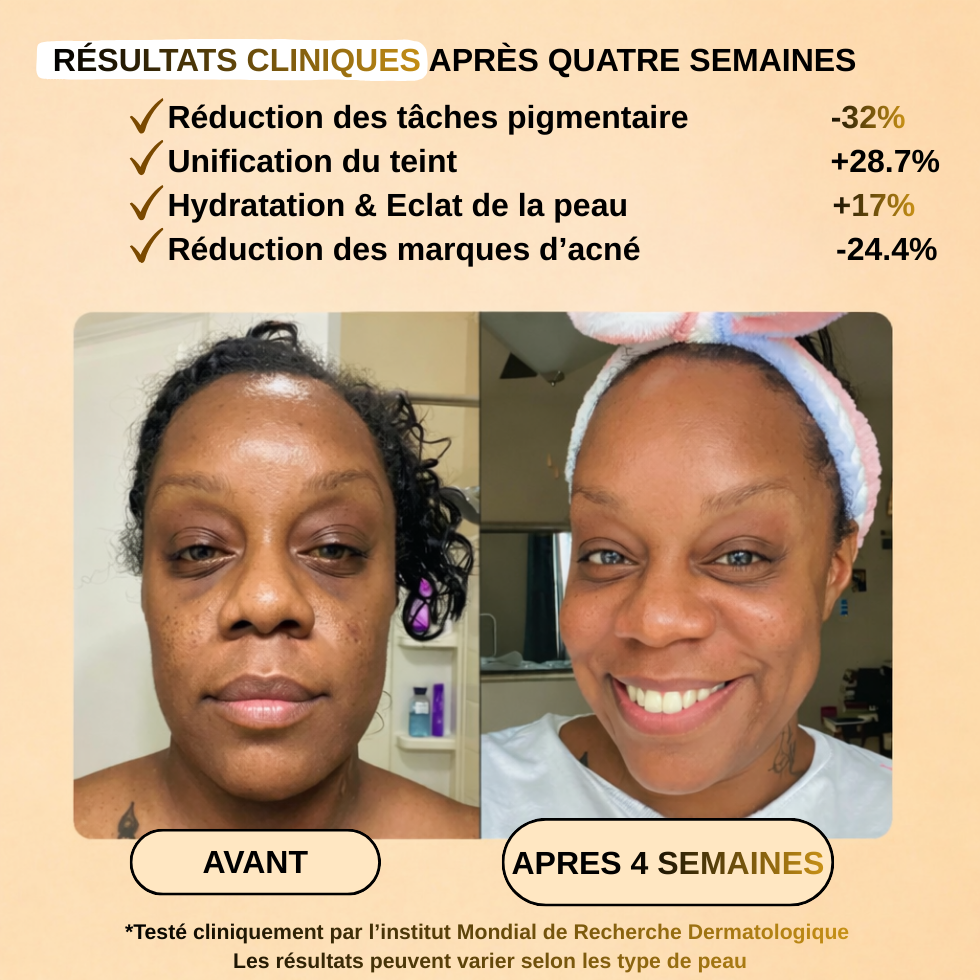 Savon curcuma - Un teint unifié et lumineux